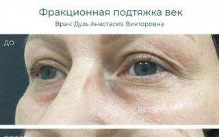 Портфолио