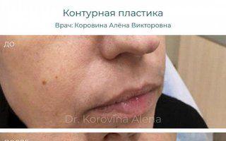 Портфолио