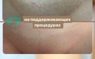 Портфолио