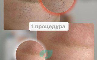 Портфолио
