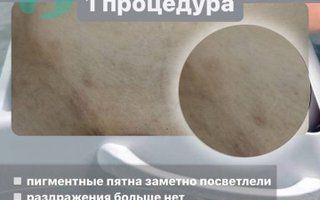 Портфолио